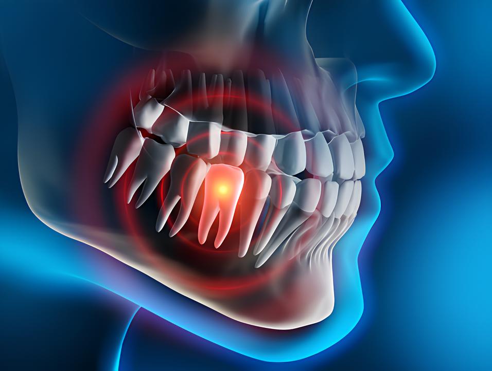 Teeth image - Emergency dentist Stevenage